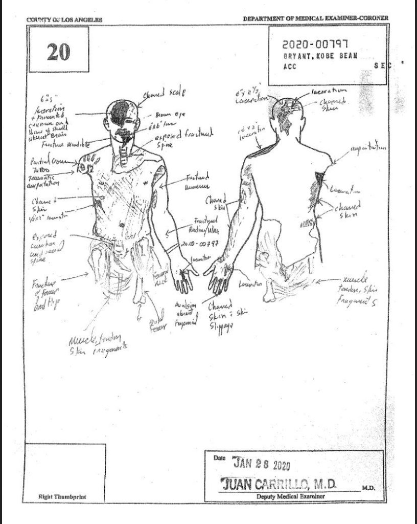 Kobe Bryant Autopsy Sketch Photos