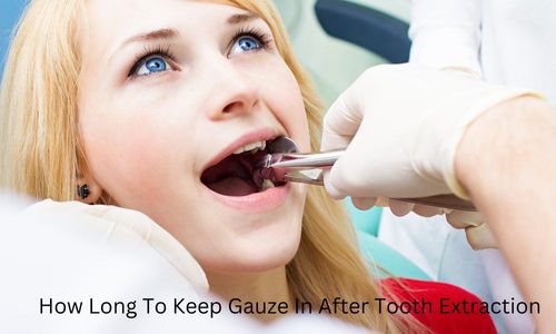 How Long To Keep Gauze In After Tooth Extraction? Dos and Don’ts