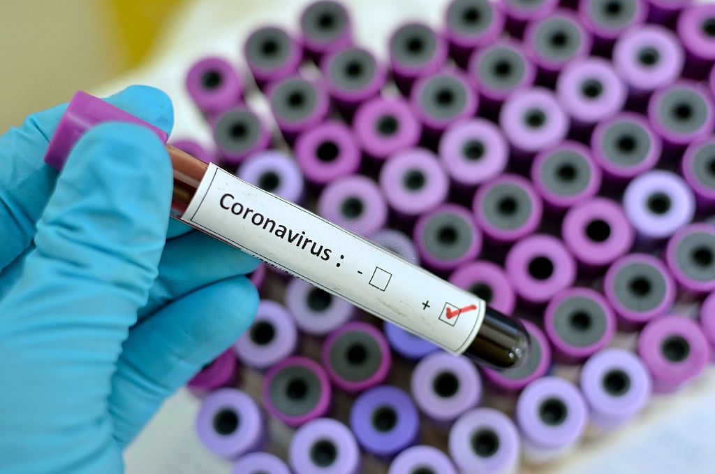 Coronavirus Symptoms