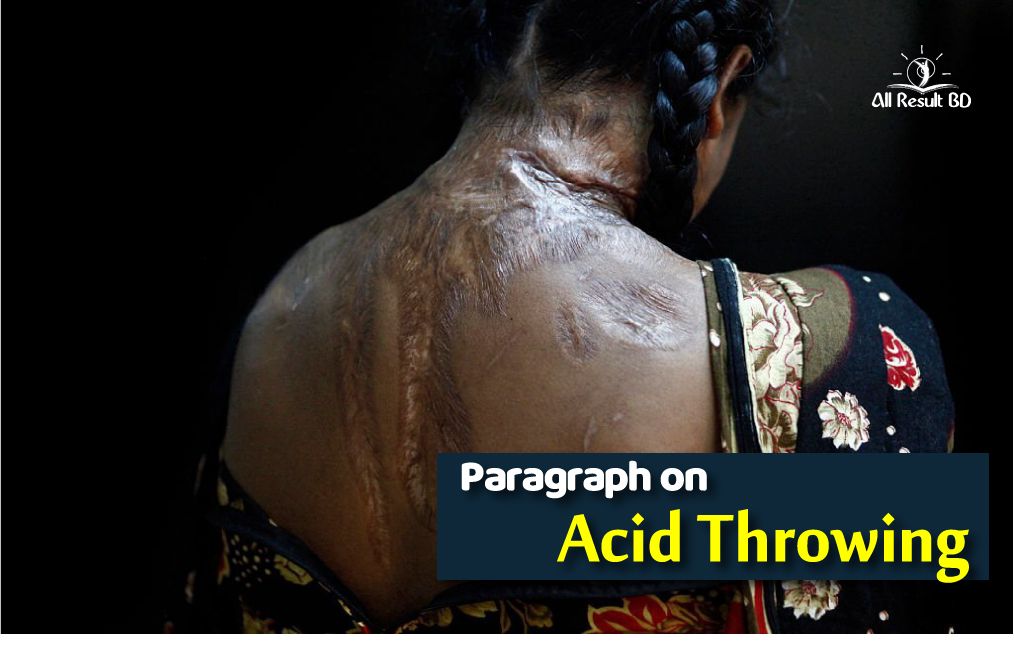 Acid Throwing Paragraph for Class 8, 9, SSC, HSC Students